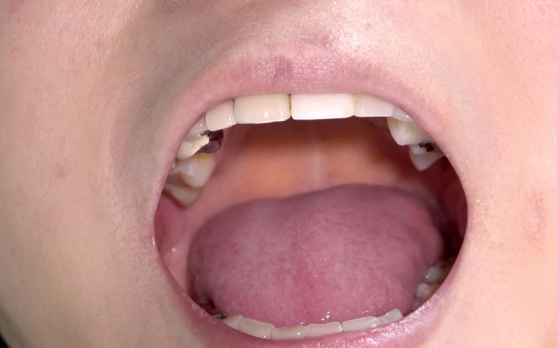 AD-287 第 5 部分 - 30 分钟