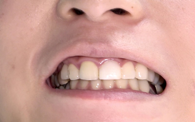 AD-287 第 6 部分 - 30 分钟