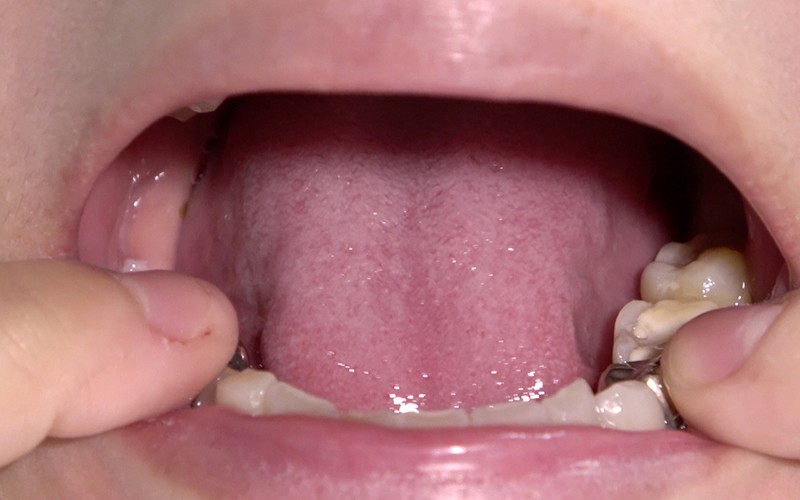 AD-287 第 8 部分 - 30 分钟