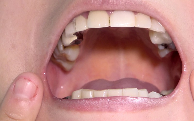 AD-287 第 9 部分 - 30 分钟