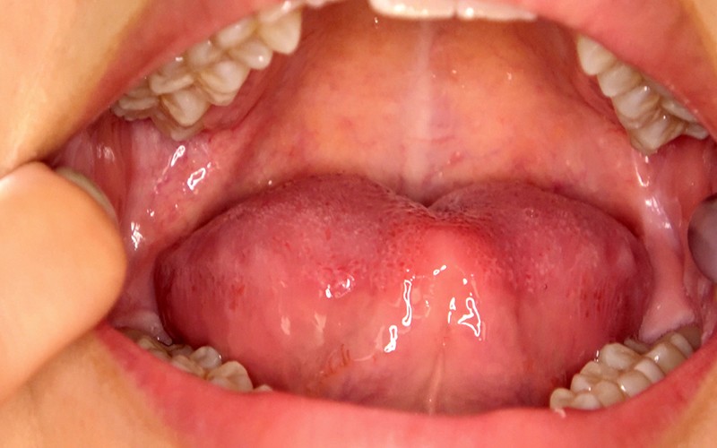 AD-289 Bagian 10 - 30 minit