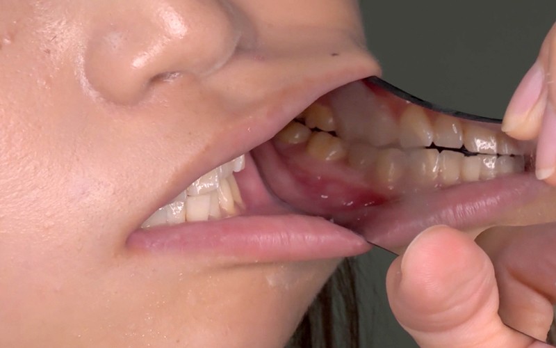 AD-291 Bagian 13 - 30 minit