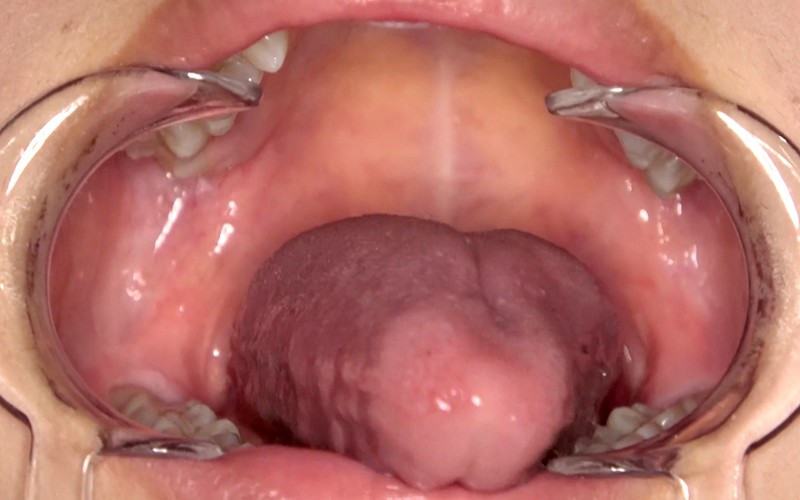 AD-308 Part 14 - 30 minutes