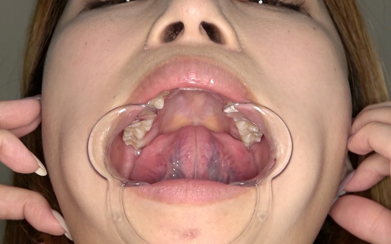 AD-308 Part 15 - 30 minutes