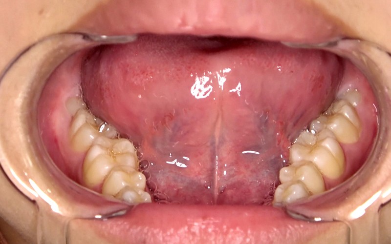 AD-308 Bagian 16 - 30 minit