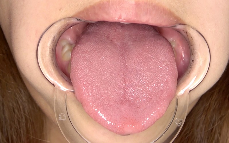 AD-308 Part 17 - 30 minutes