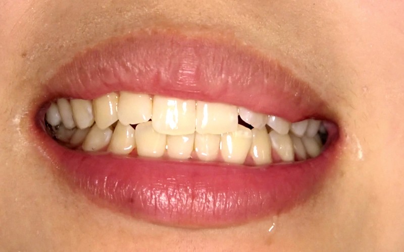 AD-308 Part 20 - 30 minutes