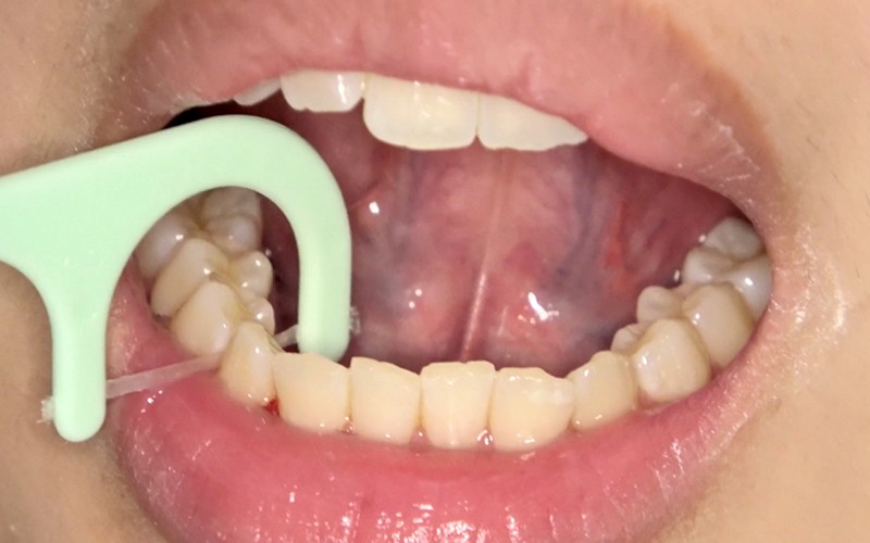 AD-308 Bagian 7 - 30 minit