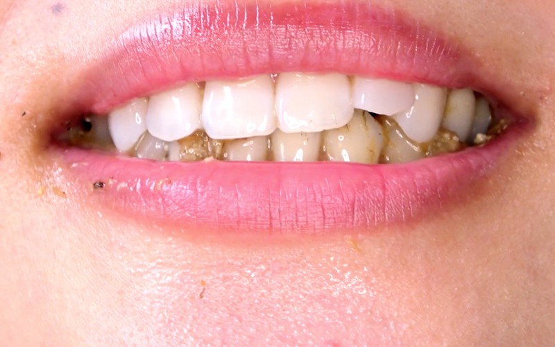 AD-310 パート 17 - 30 分