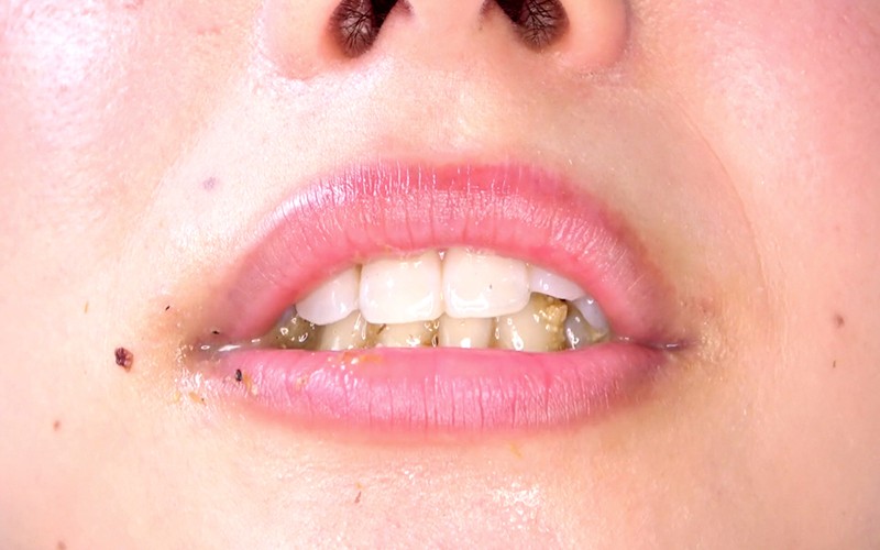 AD-310 パート 18 - 30 分