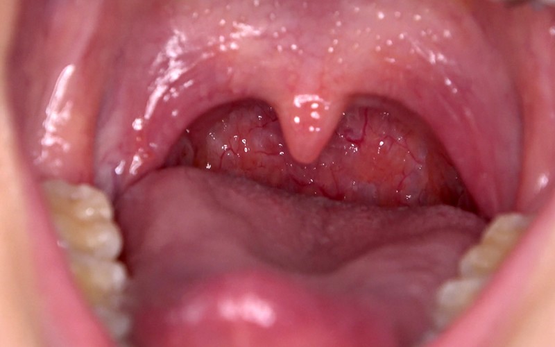 AD-311 Bagian 10 - 30 minit