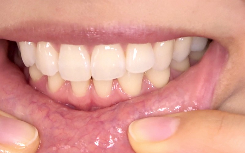 AD-311 Bagian 4 - 30 minit