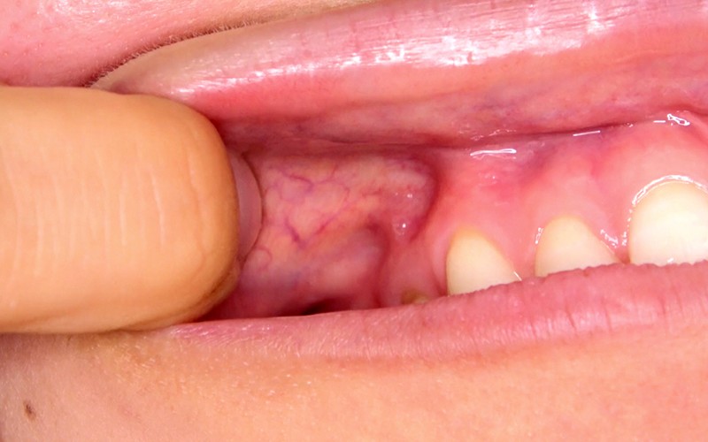 AD-311 Part 5 - 30 minutes