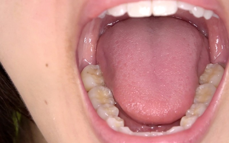 AD-311 Part 6 - 30 minutes