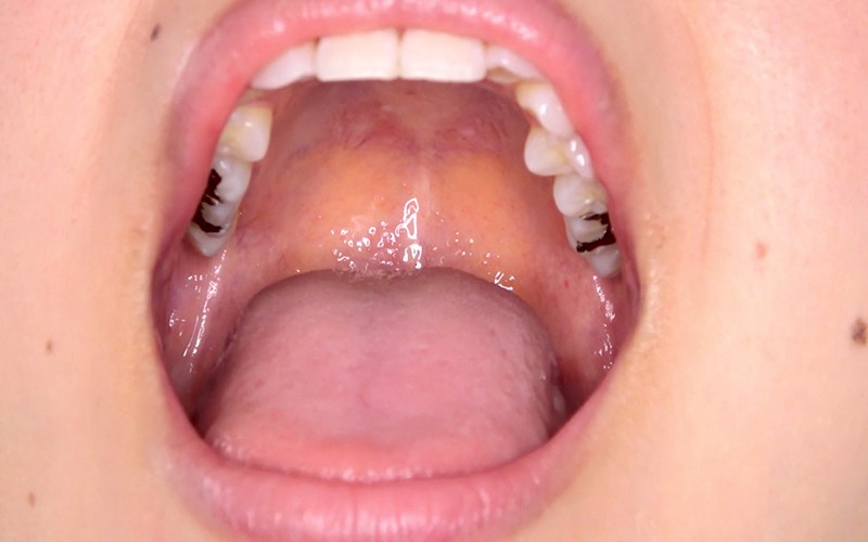 AD-311 Part 8 - 30 minutes