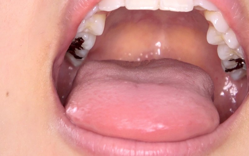 AD-311 Bagian 9 - 30 minit