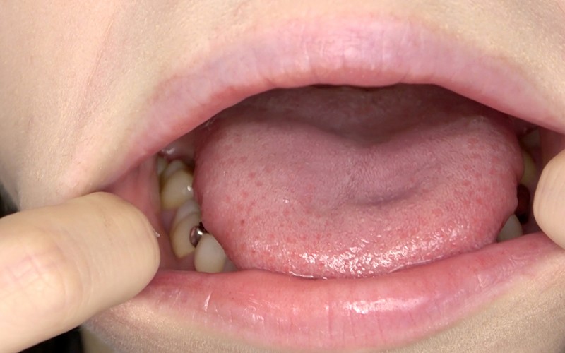 AD-322 第 12 部分 - 30 分钟