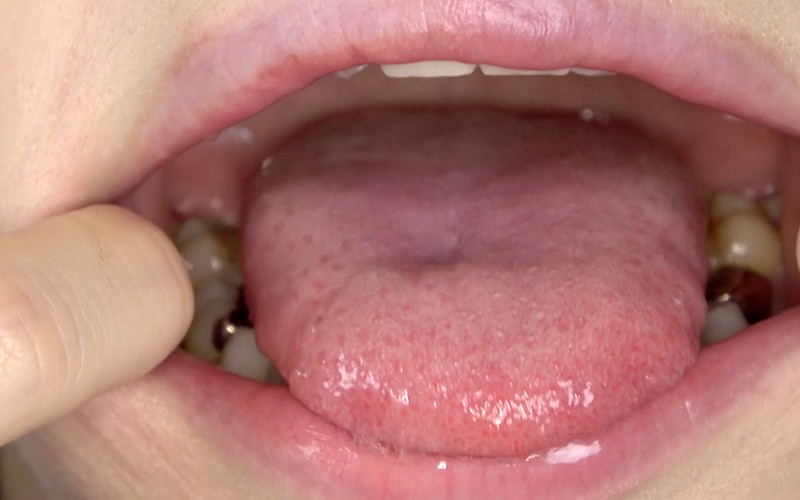 AD-322 Bagian 13 - 30 minit