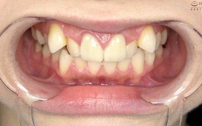 AD-322 Bagian 3 - 30 minit