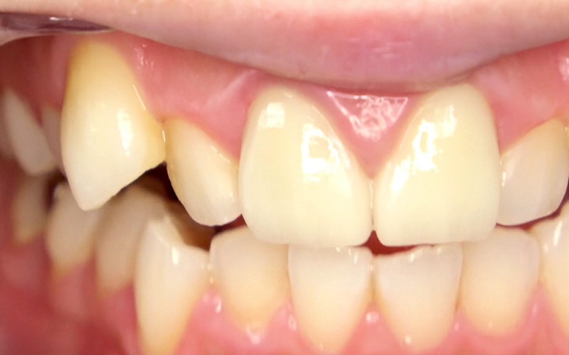 AD-322 第 4 部分 - 30 分钟