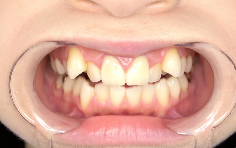 AD-322 第 5 部分 - 30 分钟