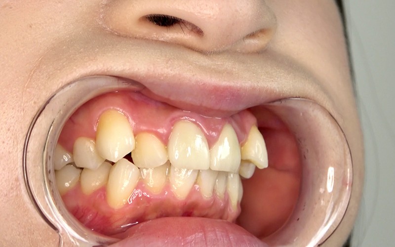 AD-322 Bagian 6 - 30 minit