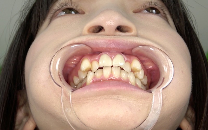 AD-322 第 7 部分 - 30 分钟