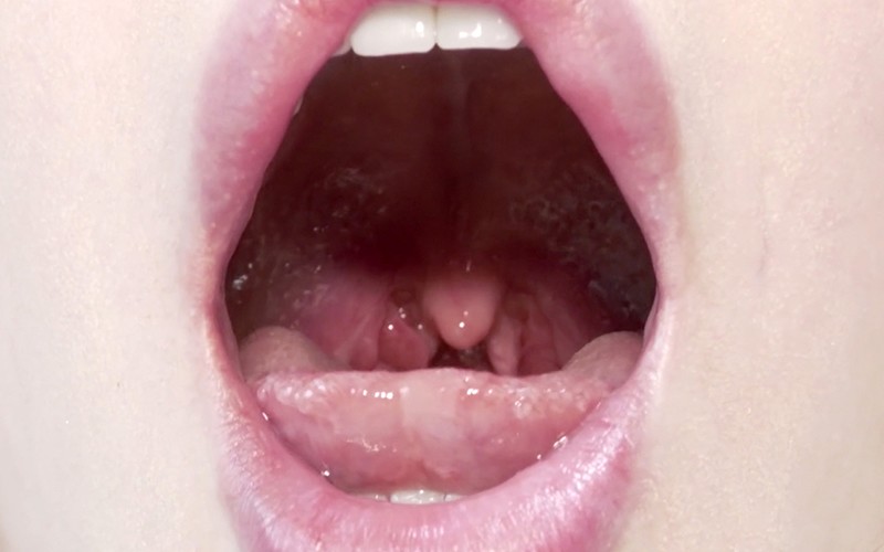 AD-338 Part 15 - 30 minutes