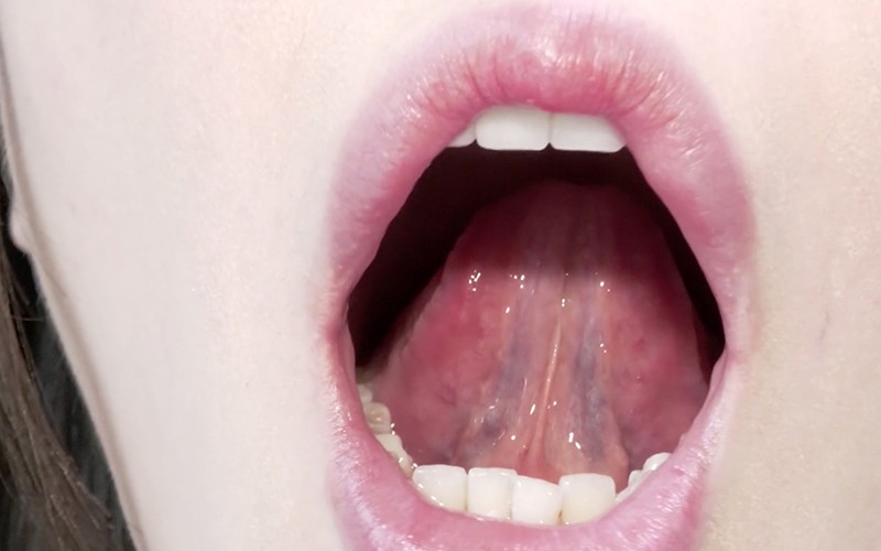 AD-338 Part 17 - 30 minutes