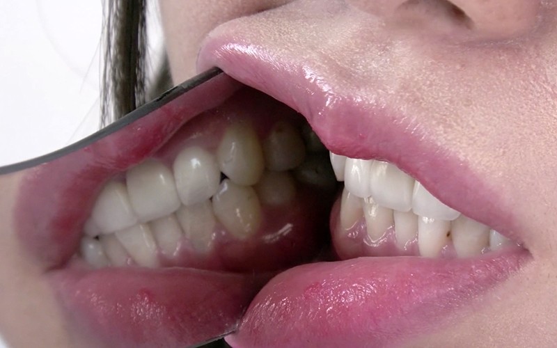 AD-340 Bagian 12 - 30 minit