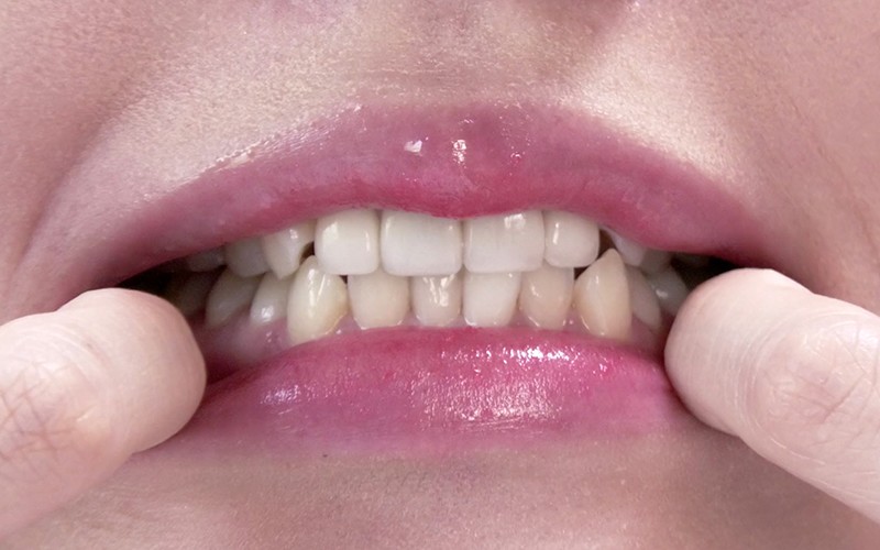 AD-340 Bagian 5 - 30 minit