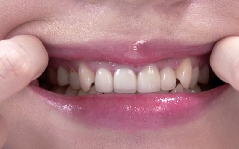 AD-340 Bagian 6 - 30 minit