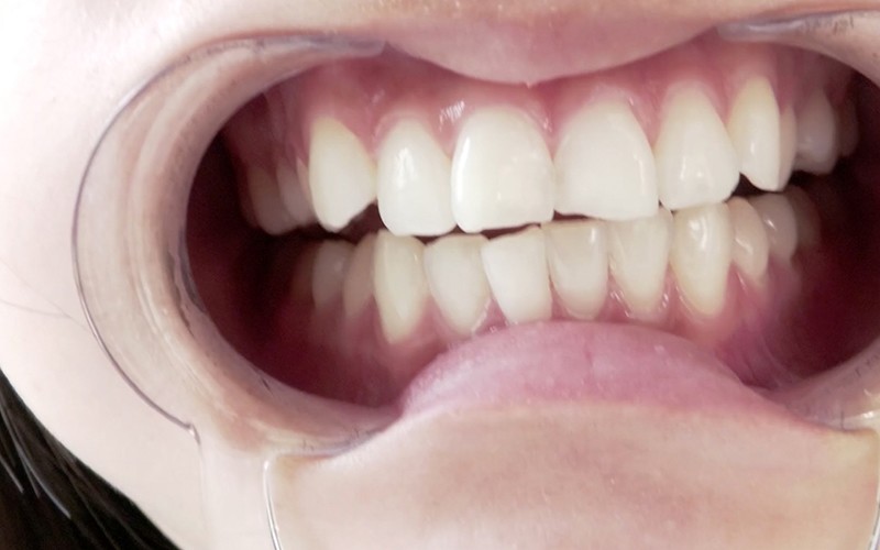 AD-370 Bagian 12 - 30 minit