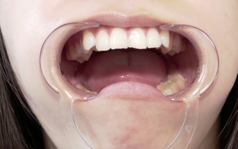 AD-370 Bagian 14 - 30 minit