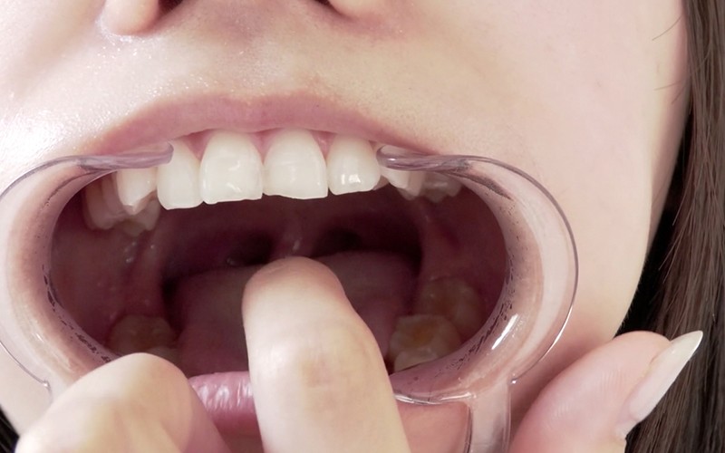 AD-370 Bagian 15 - 30 minit