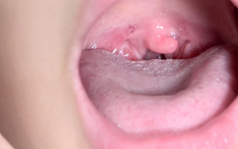 AD-374 Part 12 - 30 minutes