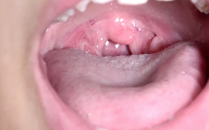 AD-374 Part 13 - 30 minutes