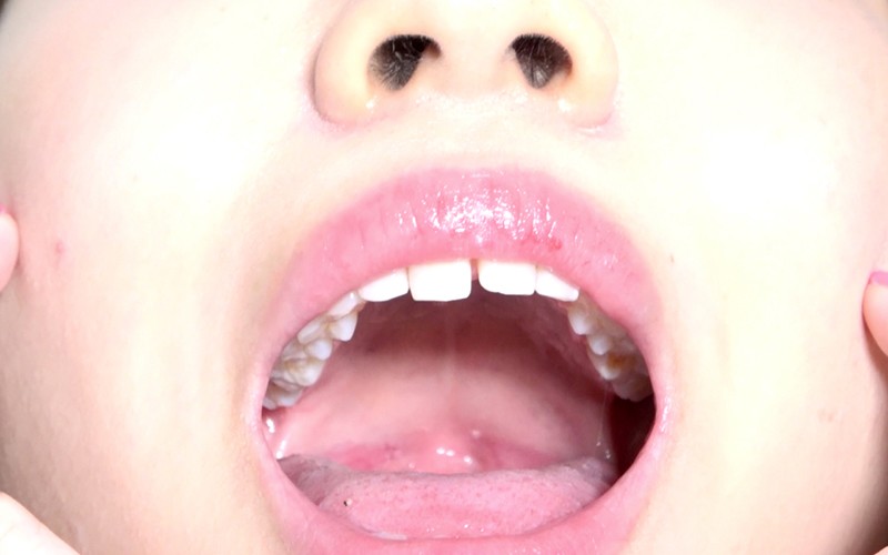 AD-374 Part 14 - 30 minutes