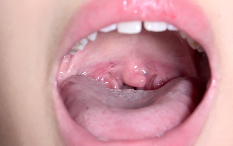 AD-374 Part 15 - 30 minutes