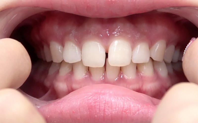 AD-374 Part 5 - 30 minutes