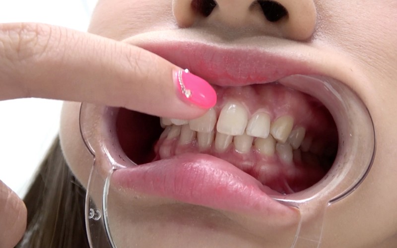 AD-374 Part 7 - 30 minutes