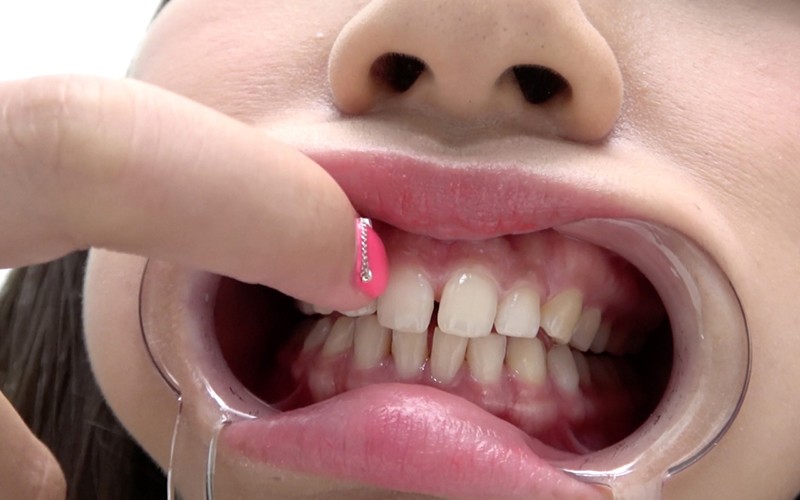 AD-374 Part 9 - 30 minutes