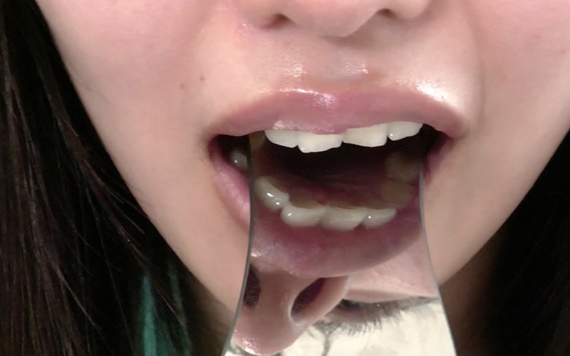 AD-378 Part 2 - 31 minutes