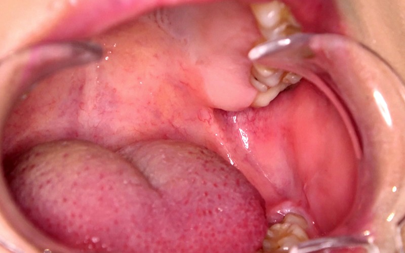 AD-382 パート 10 - 30 分