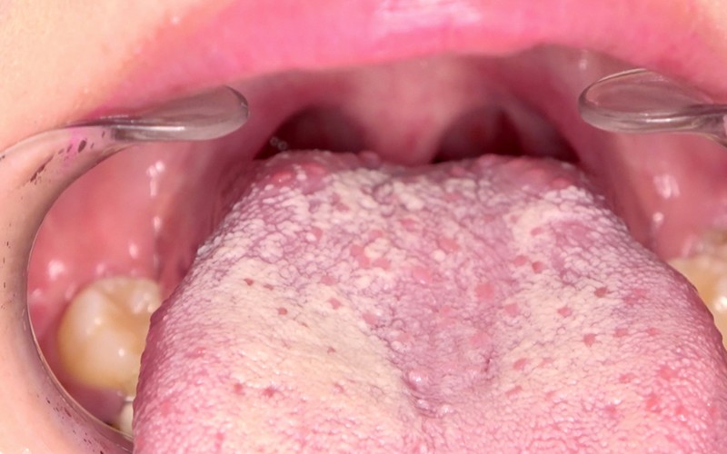 AD-382 パート 11 - 30 分