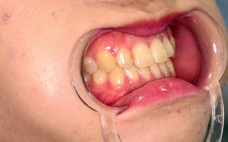 AD-382 パート 17 - 30 分