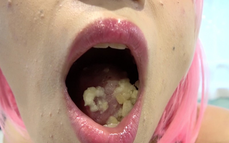 AD-382 パート 6 - 30 分