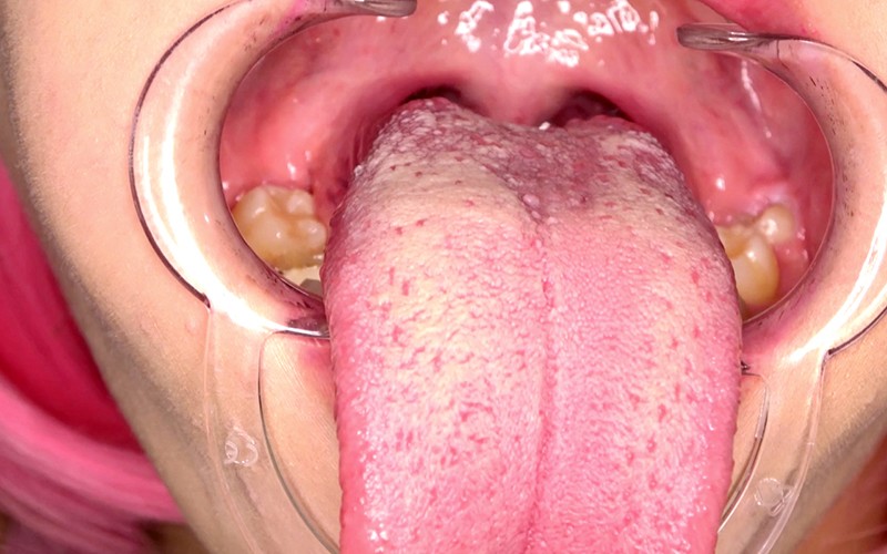 AD-382 パート 8 - 30 分