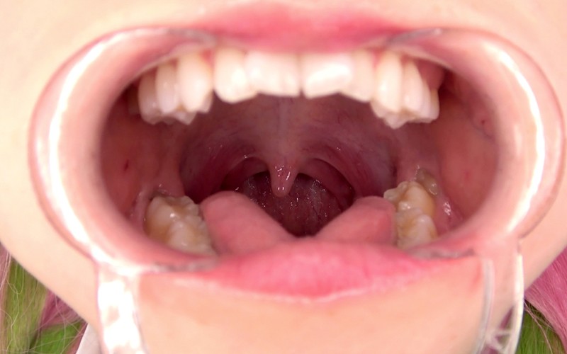 AD-398 Part 3 - 32 minutes