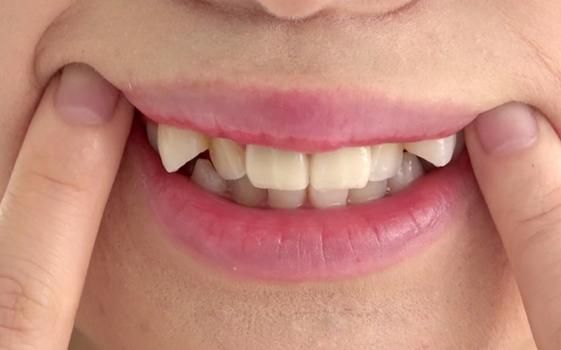 AD-416 Bagian 11 - 30 minit